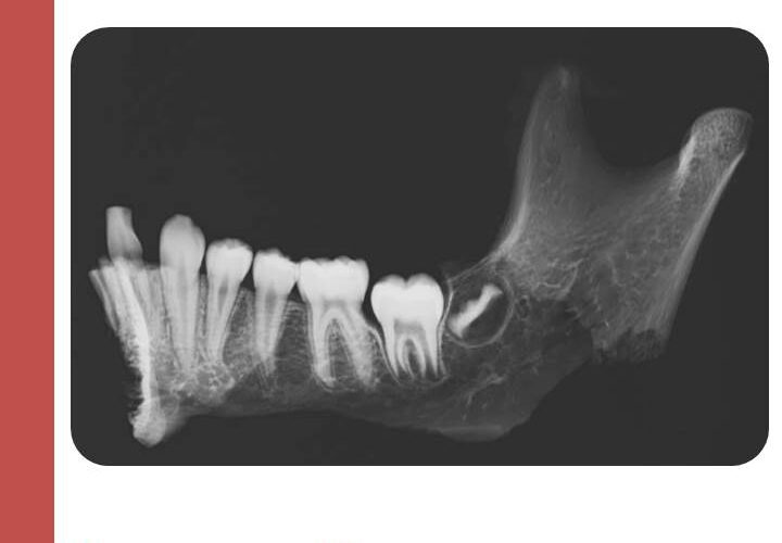 HARMONIZAÇÃO OROFACIAL: EVOLUÇÃO NORMATIVA E CONFLITOS LEGAIS NO RECONHECIMENTO DA ESPECIALIDADE